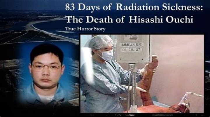 Hisashi Ouchi: The Tragic Tale of a Nuclear Accident Survivor
