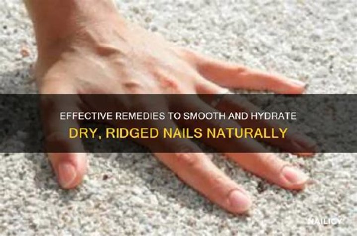 Treatment for Dry Nails with Ridges: A Comprehensive Guide to Restore Your Nail Health
